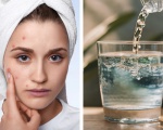 The know drinking water effectively reduces acne and beautifies the skin and keeps it in shape